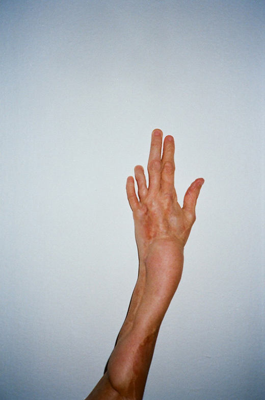 Hand, 2015
